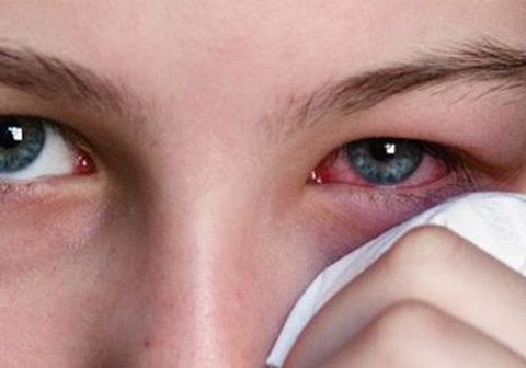 Mẹo chữa đau mắt hàn – Thợ lành nghề chia sẻ