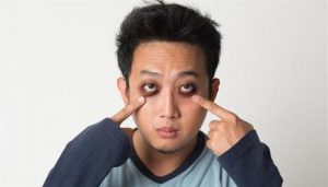 cách trị thâm quầng mắt nhanh và hiệu quả 6