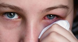 cách chữa mí mắt bị sưng 8