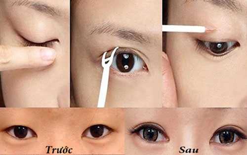 Thông tin từ A - Z về các cách tạo mắt 2 mí không phẫu thuật 3